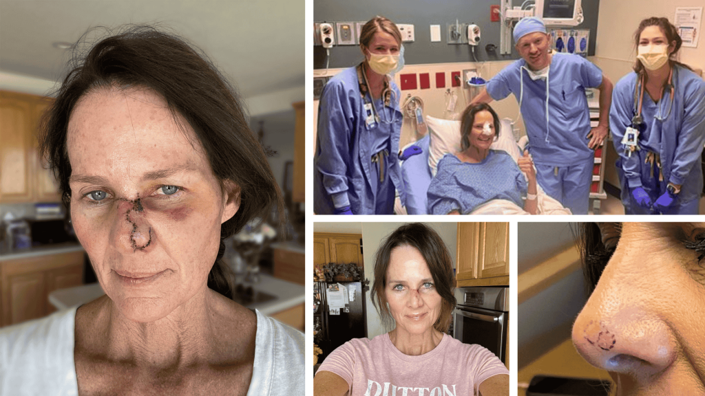 kathy sabine Skin Cancer