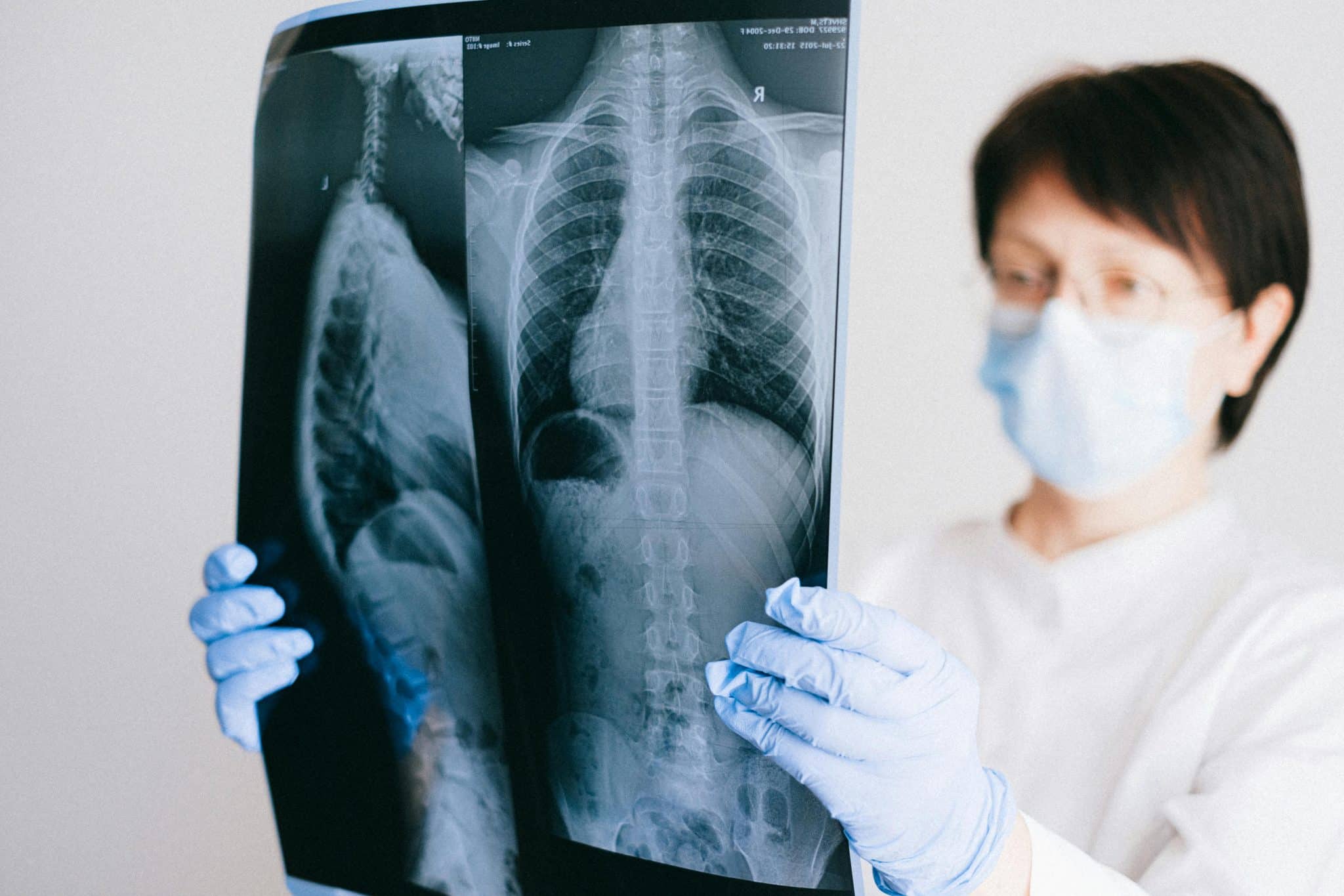 What are the Key Features of A Normal Chest X-Ray