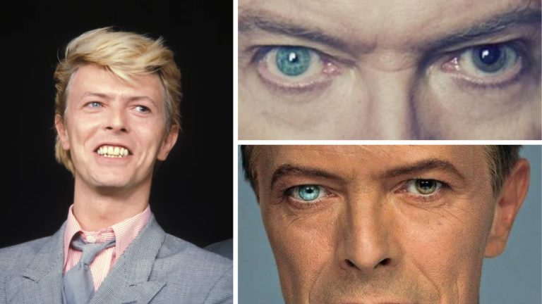 Collage of David Bowie featuring a portrait and close-up shots highlighting his distinctive mismatched eye colors.