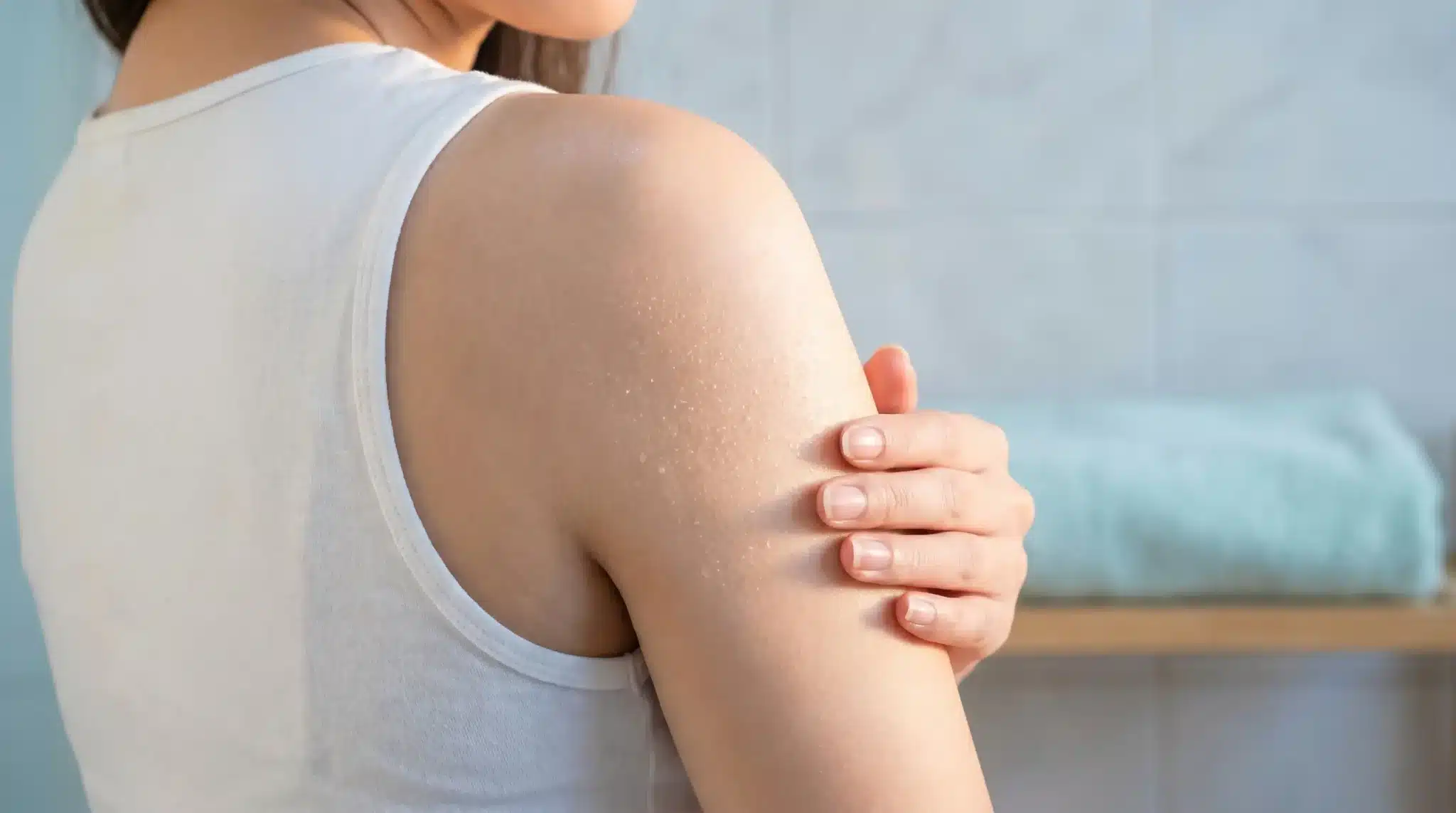 Person touching dry skin on arm in a bathroom with light blue towel in background