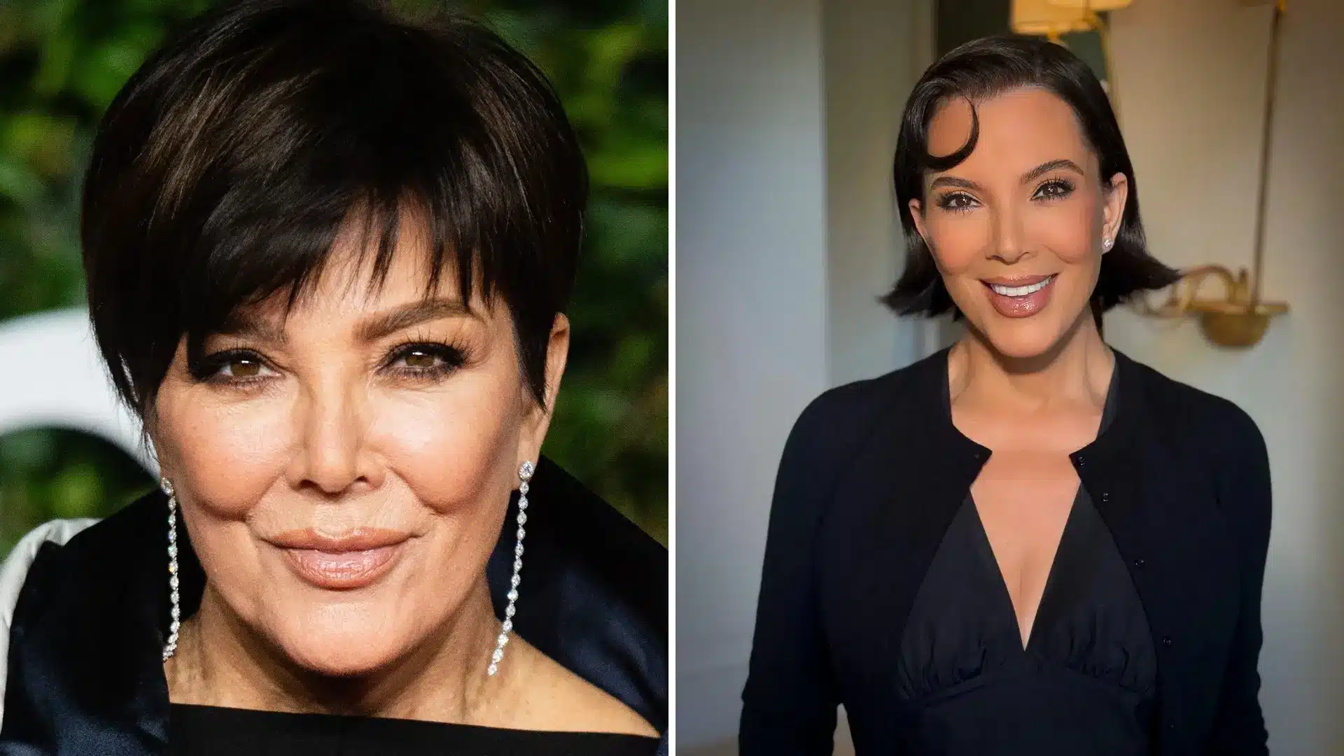 Side-by-side portraits of Kris Jenner before and after facelift surgery