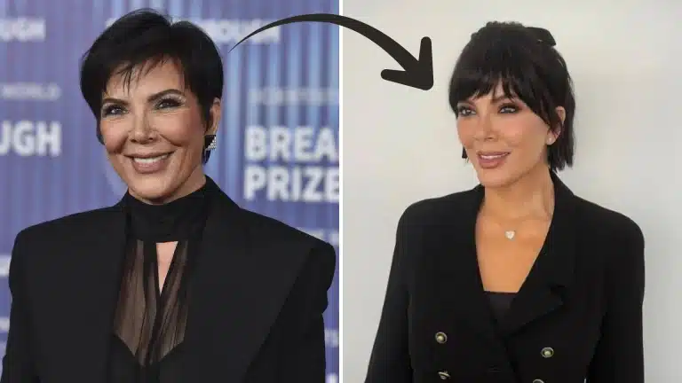 Side-by-side photos of Kris Jenner at two appearances of before and after the facelift
